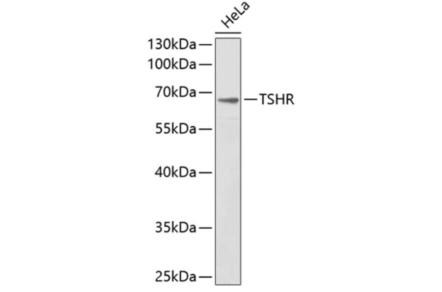 Western Blot - Anti-TSHR Antibody (A1012) - Antibodies.com