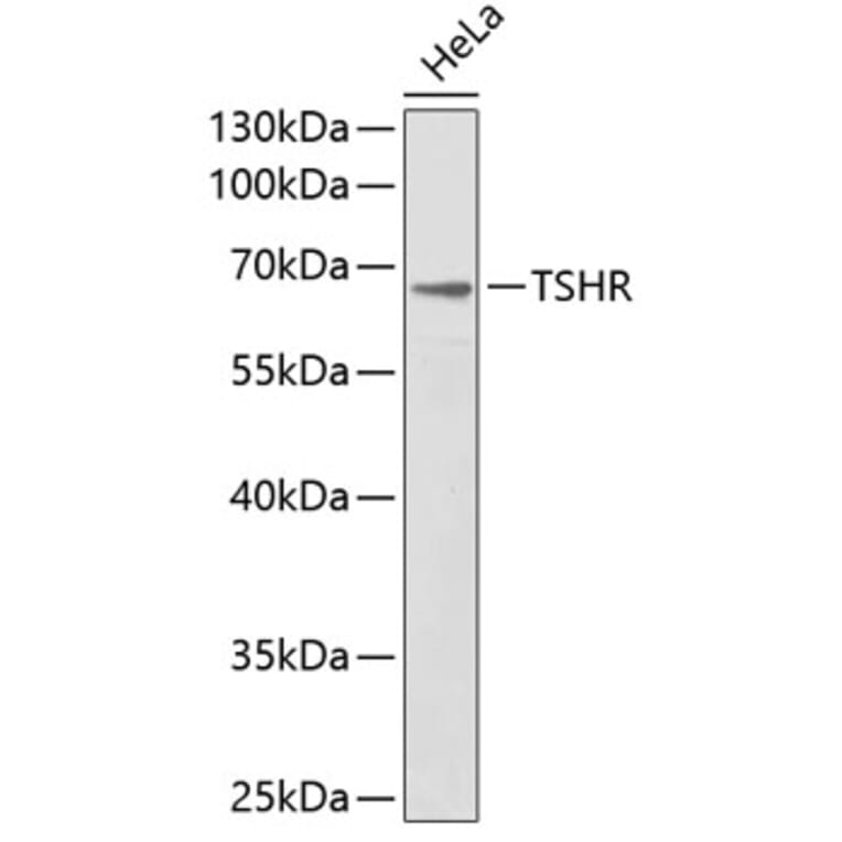 Western Blot - Anti-TSHR Antibody (A1012) - Antibodies.com