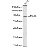 Western Blot - Anti-TSHR Antibody (A1012) - Antibodies.com