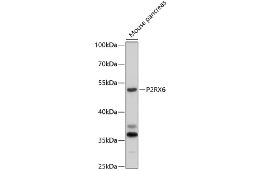 Western Blot - Anti-P2RX6 Antibody (A10131) - Antibodies.com