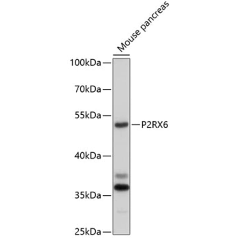 Western Blot - Anti-P2RX6 Antibody (A10131) - Antibodies.com