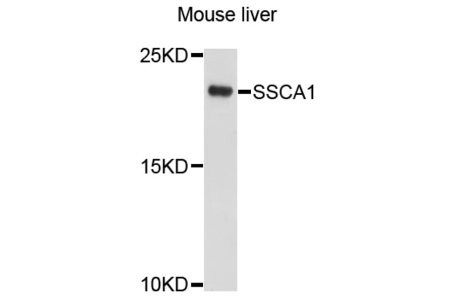 Western Blot - Anti-SSSCA1 Antibody (A10137) - Antibodies.com