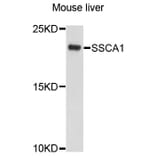 Western Blot - Anti-SSSCA1 Antibody (A10137) - Antibodies.com