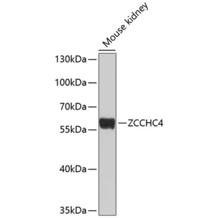Western Blot - Anti-ZCCHC4 Antibody (A16979) - Antibodies.com