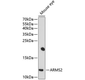 Western Blot - Anti-ARMS2 Antibody (A16980) - Antibodies.com