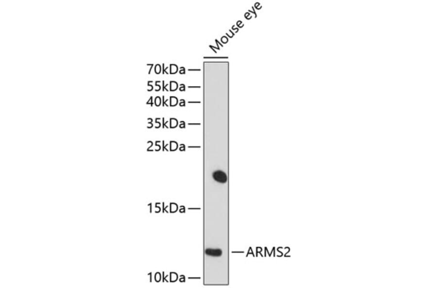 Western Blot - Anti-ARMS2 Antibody (A16980) - Antibodies.com