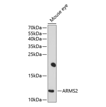 Western Blot - Anti-ARMS2 Antibody (A16980) - Antibodies.com