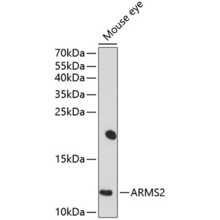 Western Blot - Anti-ARMS2 Antibody (A16980) - Antibodies.com