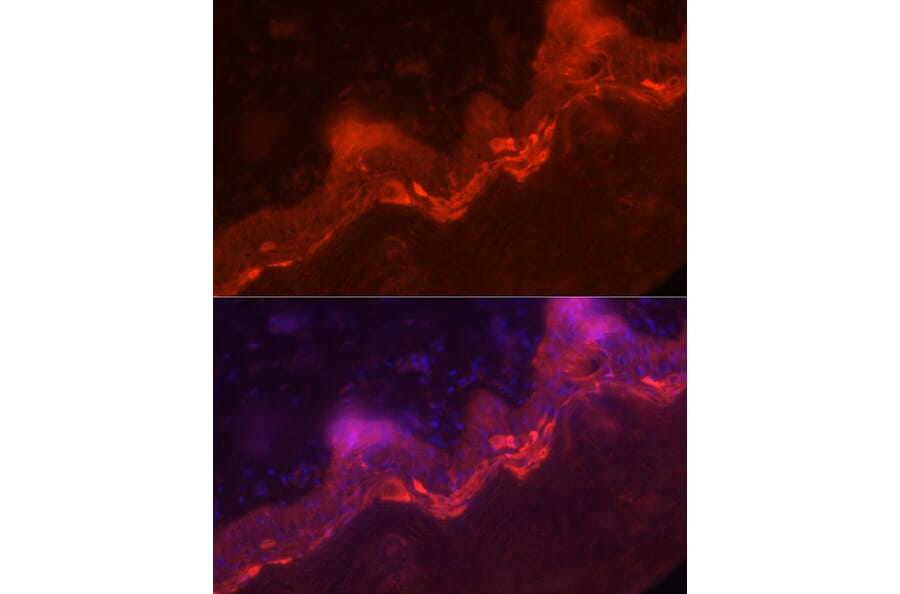 Immunofluorescence - Anti-IL36 gamma/IL-1F9 Antibody (A16981) - Antibodies.com
