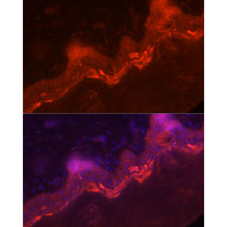 Immunofluorescence - Anti-IL36 gamma/IL-1F9 Antibody (A16981) - Antibodies.com