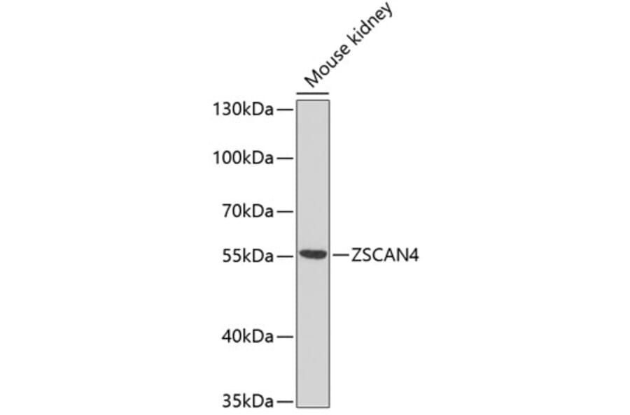 Western Blot - Anti-ZSCAN4C Antibody (A16982) - Antibodies.com