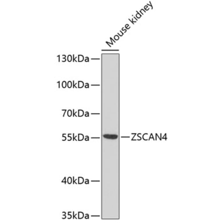 Western Blot - Anti-ZSCAN4C Antibody (A16982) - Antibodies.com