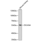 Western Blot - Anti-ZSCAN4C Antibody (A16982) - Antibodies.com
