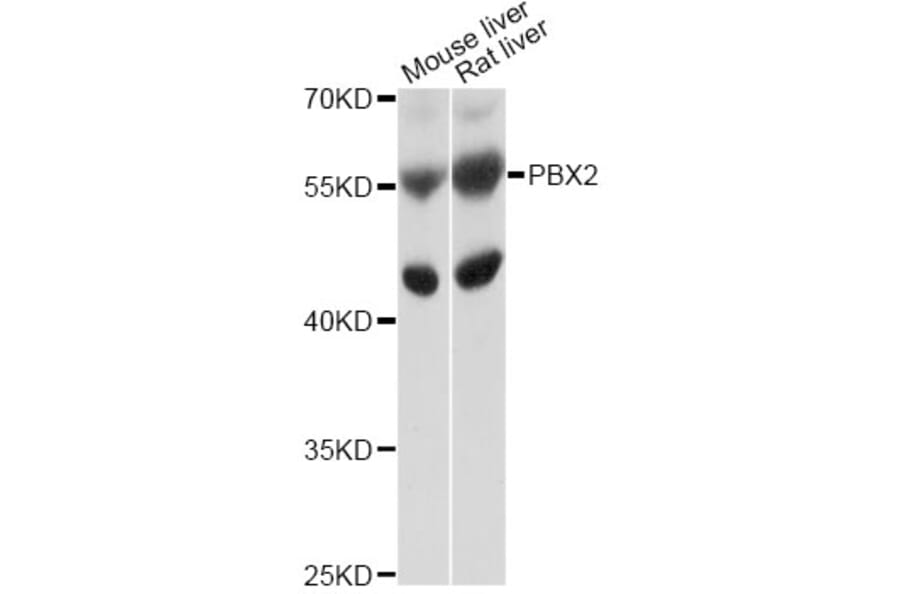 Western Blot - Anti-PBX2 Antibody (A10233) - Antibodies.com