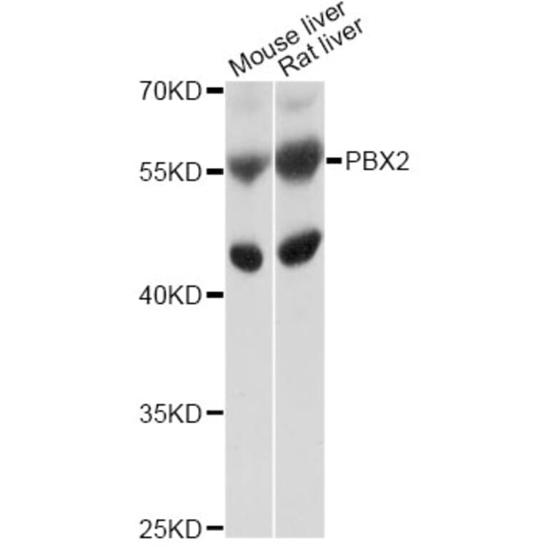 Western Blot - Anti-PBX2 Antibody (A10233) - Antibodies.com