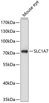 Western blot analysis of extracts of mouse eye, using Anti-SLC1A7 Antibody (A10244) at 1:1,000 dilution.
Secondary antibody: Goat Anti-Rabbit IgG (H+L) (HRP) (AS014) at 1:10,000 dilution.
Lysates / proteins: 25µg per lane.
Blocking buffer: 3% non-fat dry milk in TBST.
Detection: ECL Basic Kit (RM00020).
Exposure time: 30s.