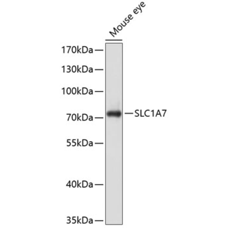Western Blot - Anti-EAAT5 Antibody (A16984) - Antibodies.com