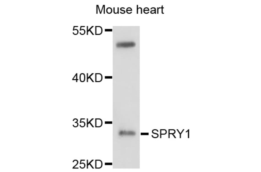 Western Blot - Anti-SPRY1 Antibody (A10278) - Antibodies.com
