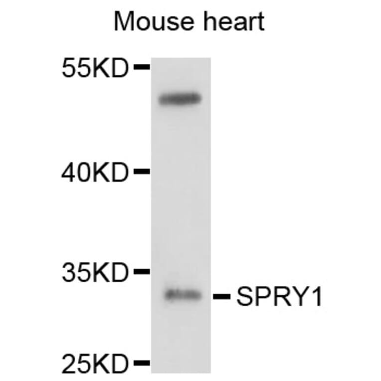 Western Blot - Anti-SPRY1 Antibody (A10278) - Antibodies.com