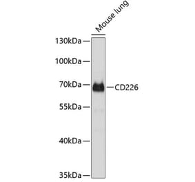 Western Blot - Anti-CD226 Antibody (A16986) - Antibodies.com