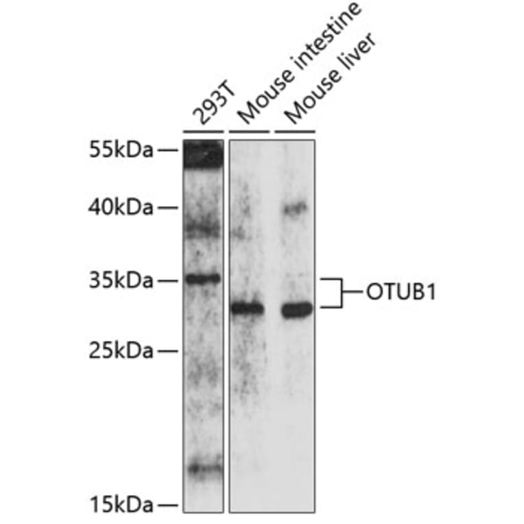 Western Blot - Anti-OTUB1 Antibody (A16987) - Antibodies.com