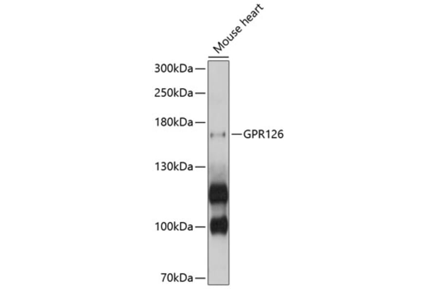Western Blot - Anti-GPR126 Antibody (A10318) - Antibodies.com