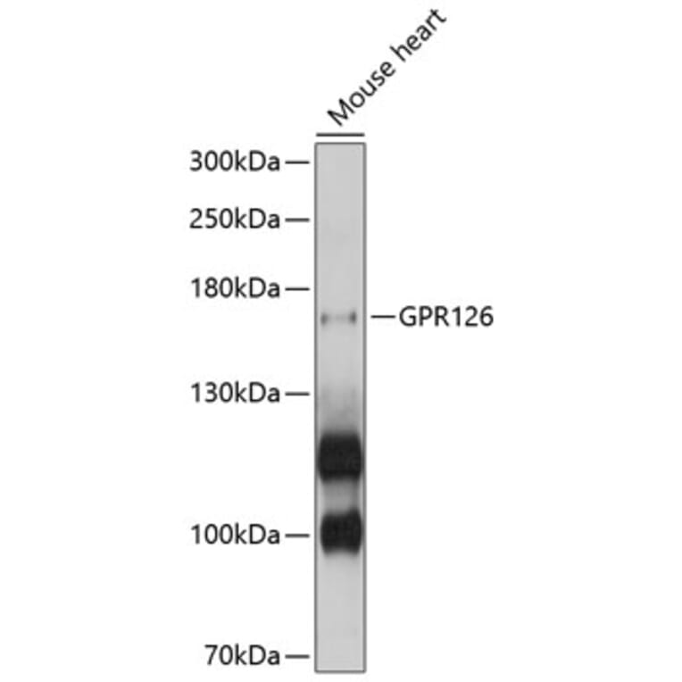 Western Blot - Anti-GPR126 Antibody (A10318) - Antibodies.com