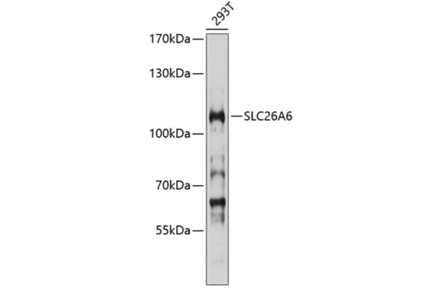 Western Blot - Anti-SLC26A6/Pat1 Antibody (A16989) - Antibodies.com