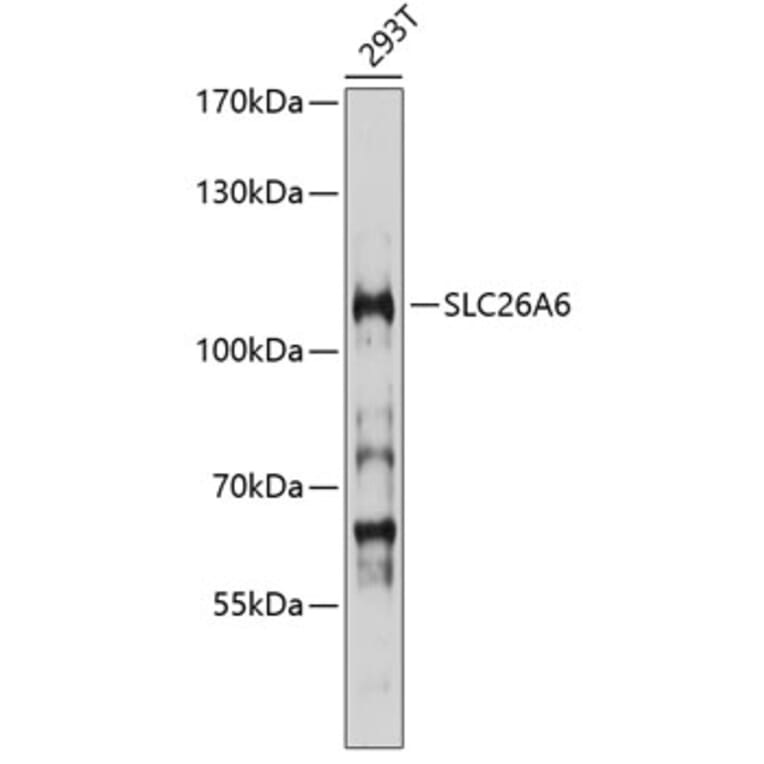 Western Blot - Anti-SLC26A6/Pat1 Antibody (A16989) - Antibodies.com