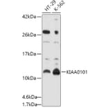 Western Blot - Anti-KIAA0101 Antibody (A16990) - Antibodies.com