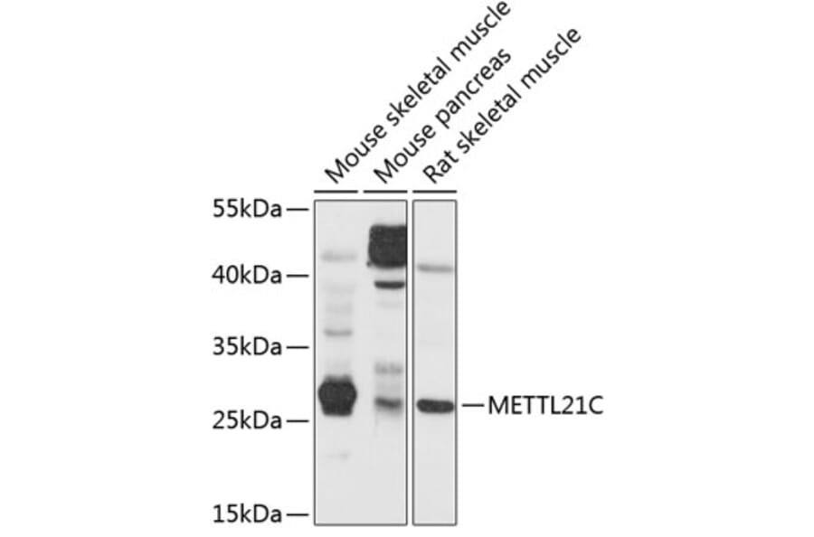 Western Blot - Anti-METTL21C Antibody (A16991) - Antibodies.com