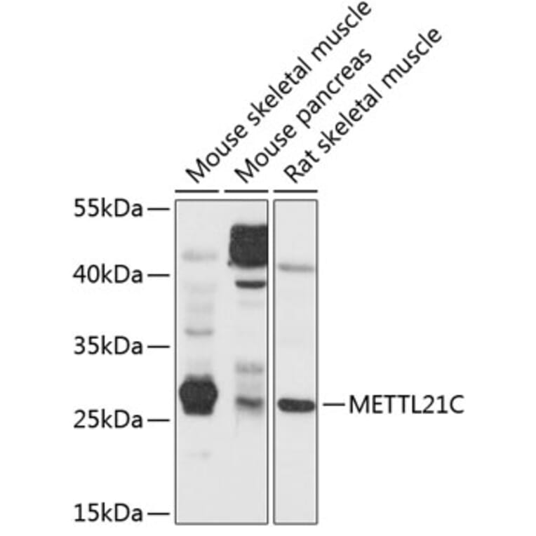 Western Blot - Anti-METTL21C Antibody (A16991) - Antibodies.com