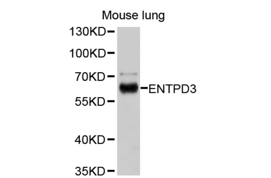 Western Blot - Anti-ENTPD3 Antibody (A10424) - Antibodies.com