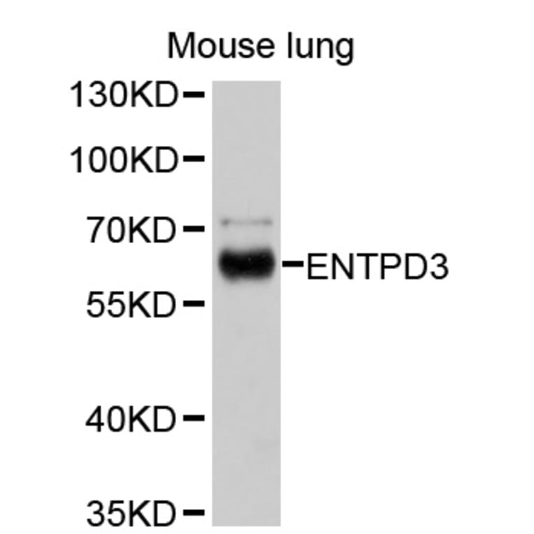 Western Blot - Anti-ENTPD3 Antibody (A10424) - Antibodies.com