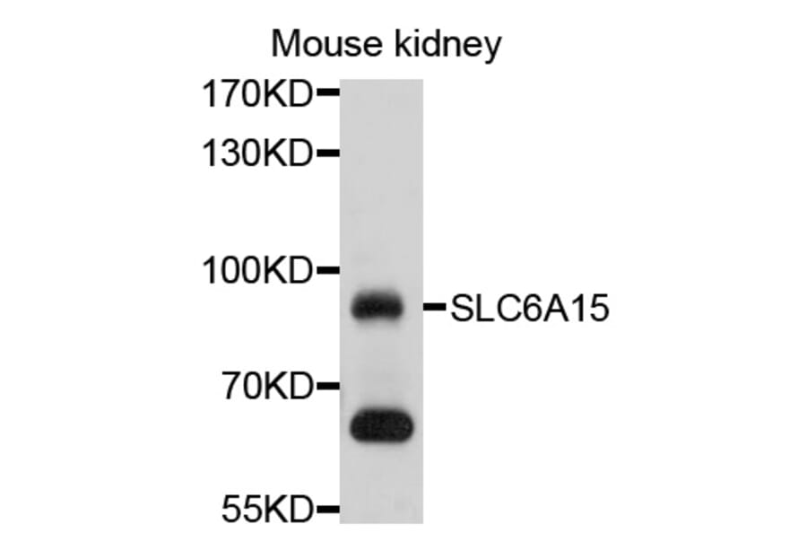 Western Blot - Anti-SLC6A15 Antibody (A10437) - Antibodies.com
