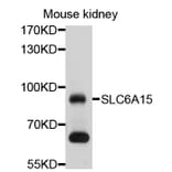 Western Blot - Anti-SLC6A15 Antibody (A10437) - Antibodies.com