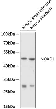Western blot analysis of extracts of various cell lines, using Anti-NOXO1 Antibody (A10477) at 1:1,000 dilution.
Secondary antibody: Goat Anti-Rabbit IgG (H+L) (HRP) (AS014) at 1:10,000 dilution.
Lysates / proteins: 25µg per lane.
Blocking buffer: 3% non-fat dry milk in TBST.
Detection: ECL Basic Kit (RM00020).
Exposure time: 10s.
