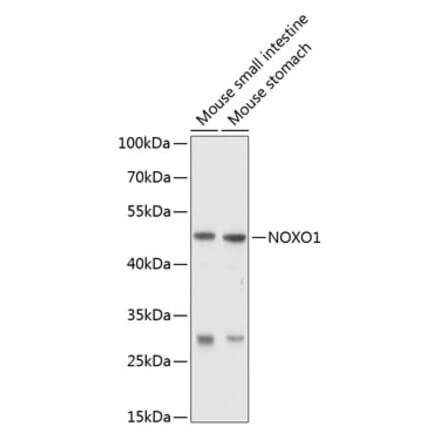 Western Blot - Anti-NOXO1 Antibody (A16995) - Antibodies.com