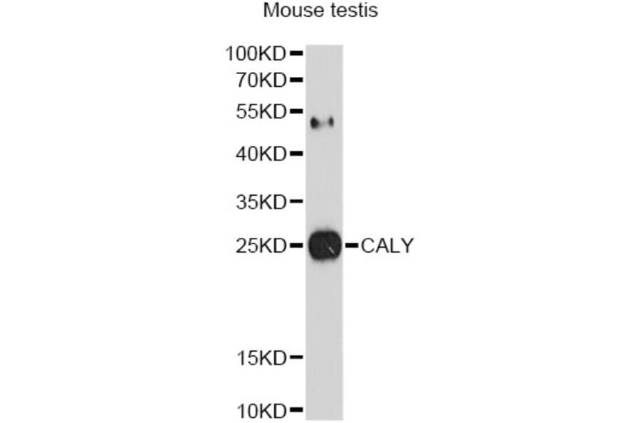 Western Blot - Anti-CALY Antibody (A10499) - Antibodies.com