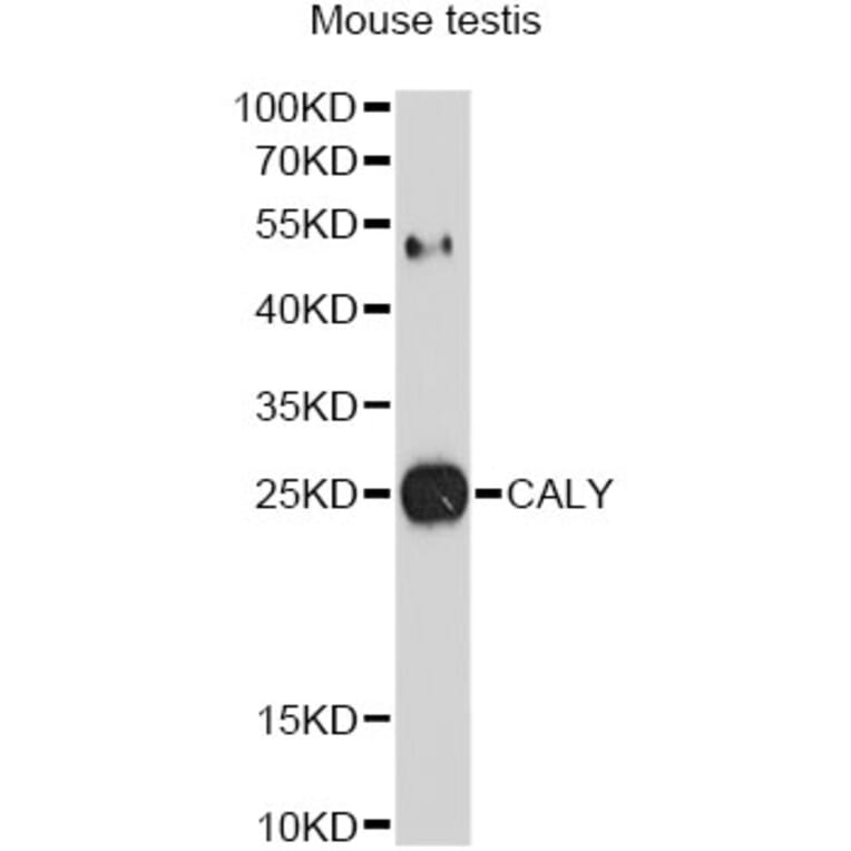 Western Blot - Anti-CALY Antibody (A10499) - Antibodies.com