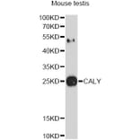 Western Blot - Anti-CALY Antibody (A10499) - Antibodies.com