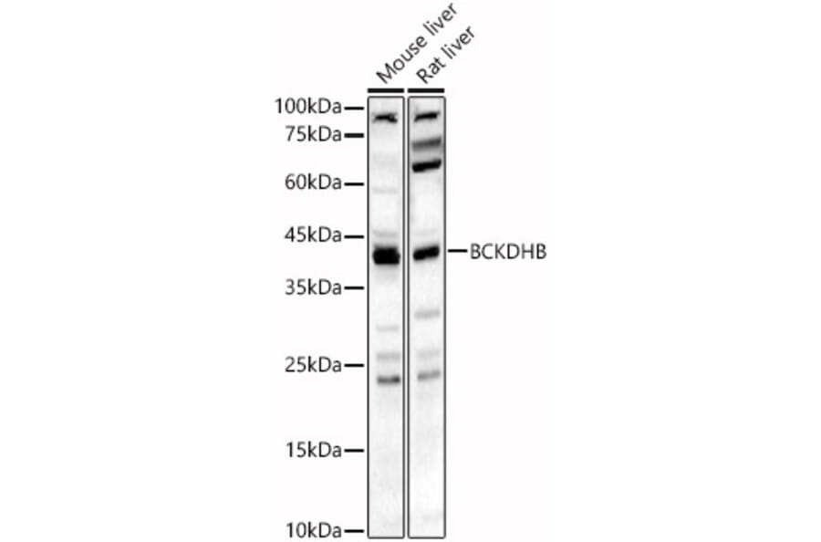 Western Blot - Anti-BCKDHB Antibody (A16999) - Antibodies.com