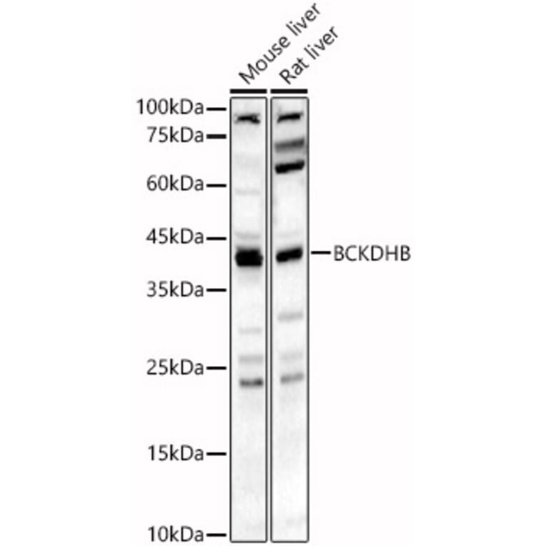 Western Blot - Anti-BCKDHB Antibody (A16999) - Antibodies.com