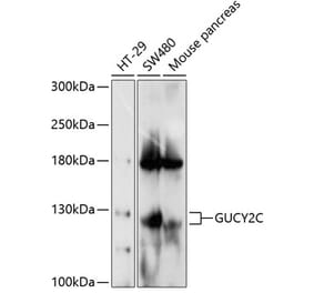 Western Blot - Anti-GC-C Antibody (A17000) - Antibodies.com