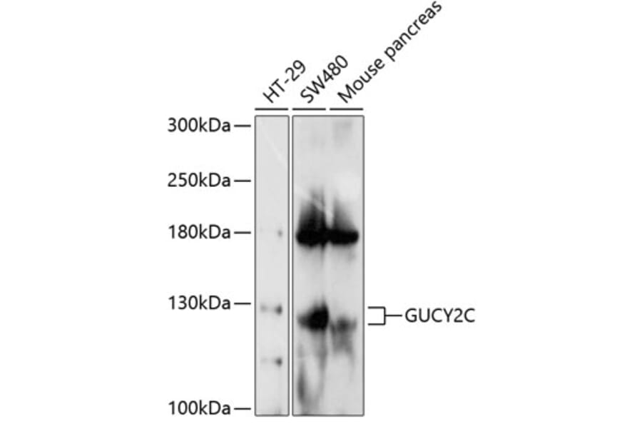 Western Blot - Anti-GC-C Antibody (A17000) - Antibodies.com