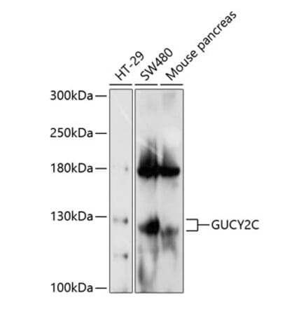 Western Blot - Anti-GC-C Antibody (A17000) - Antibodies.com