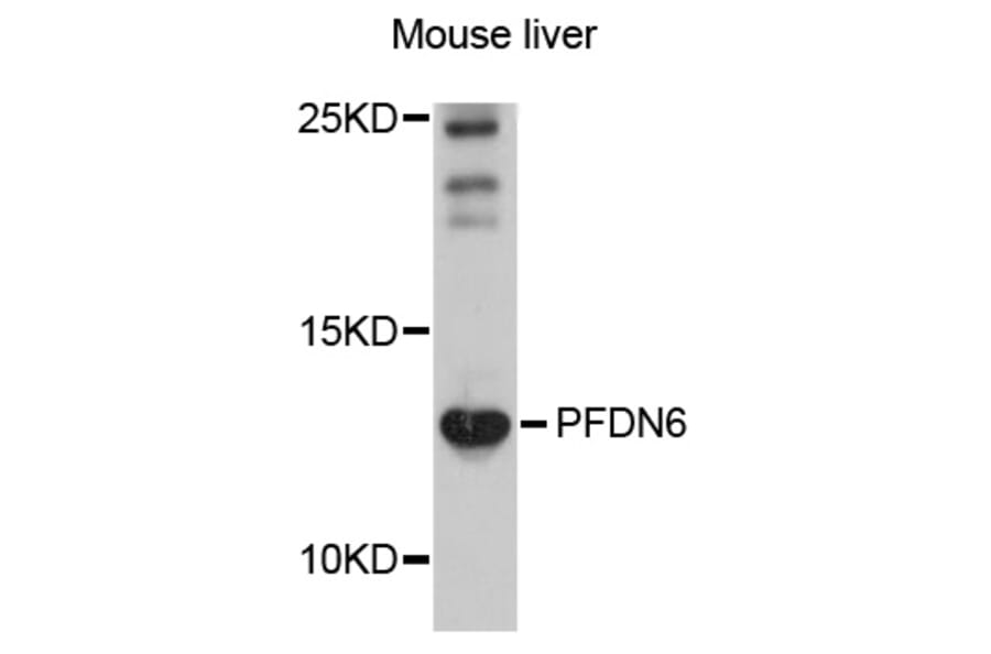 Western Blot - Anti-PFDN6 Antibody (A10580) - Antibodies.com