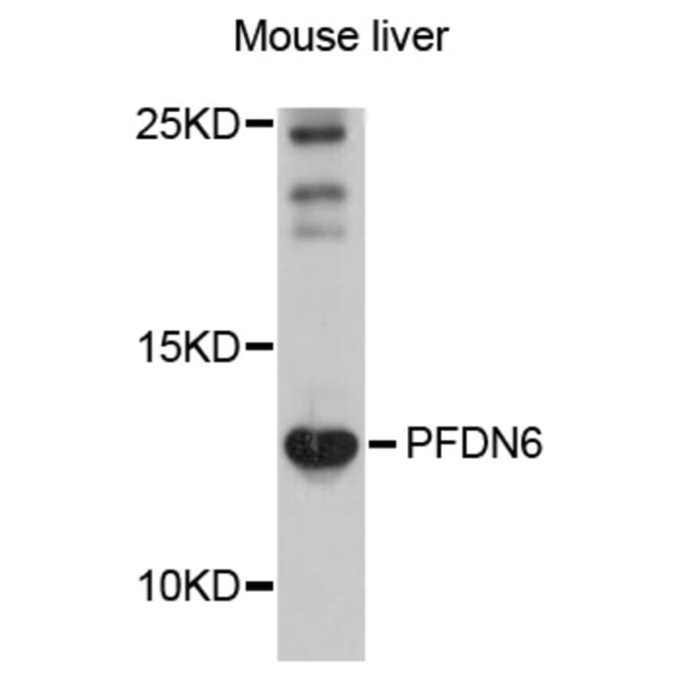 Western Blot - Anti-PFDN6 Antibody (A10580) - Antibodies.com