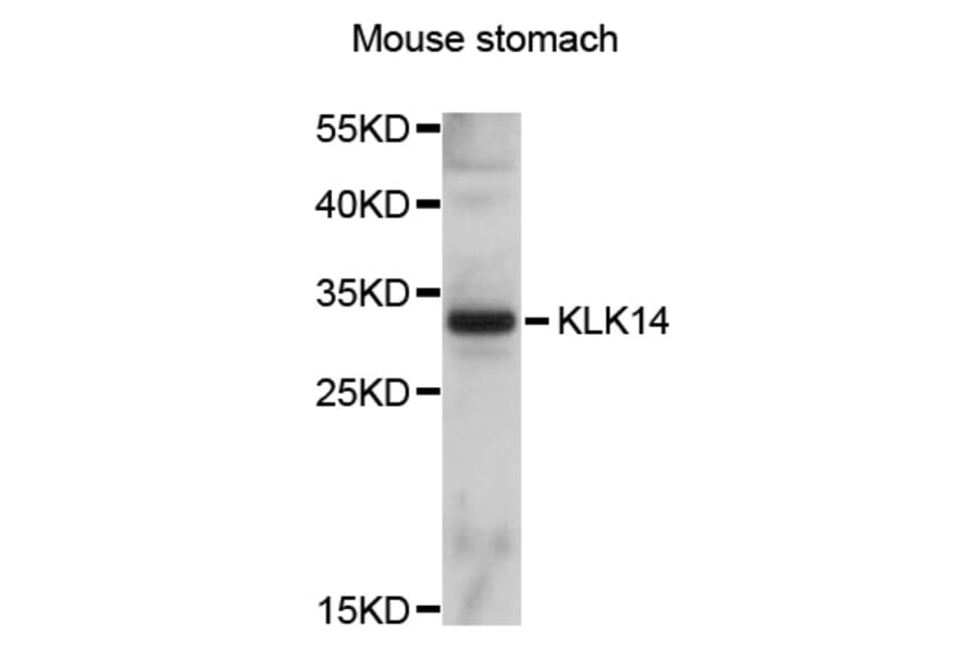 Western Blot - Anti-KLK14 Antibody (A10767) - Antibodies.com