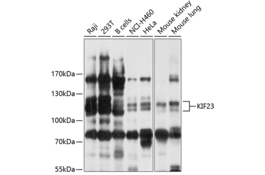 Western Blot - Anti-KIF23 Antibody (A10800) - Antibodies.com